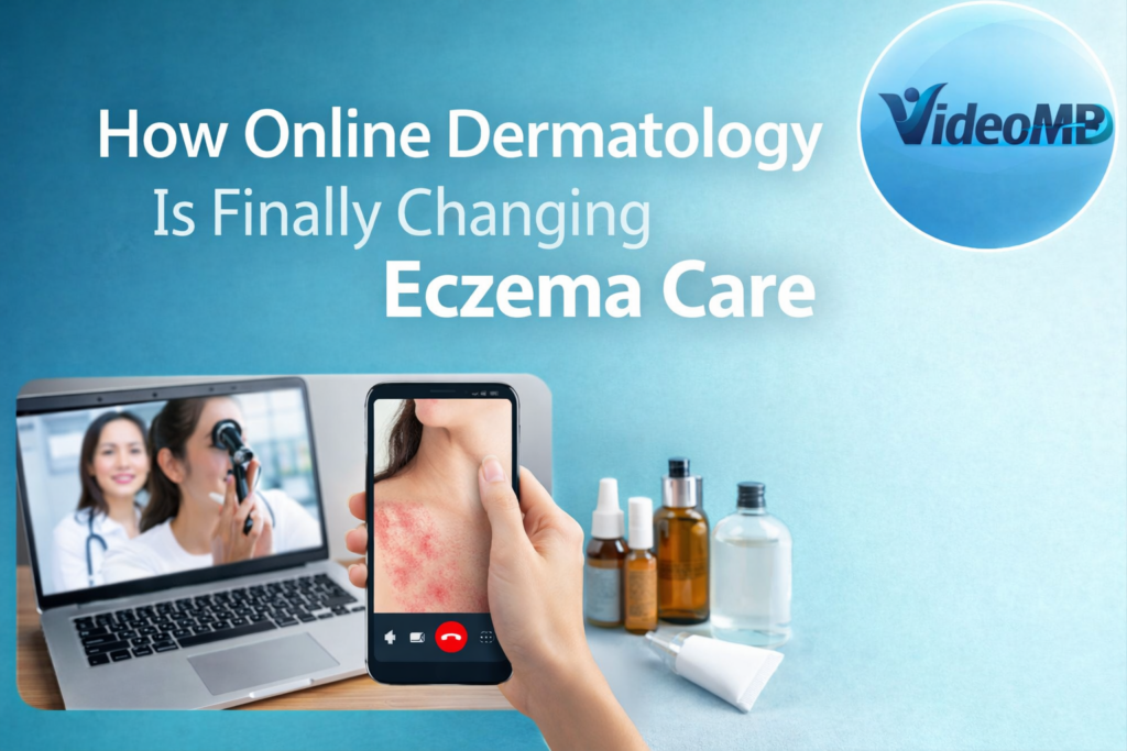 How Online Dermatology Is Finally Changing Eczema Care