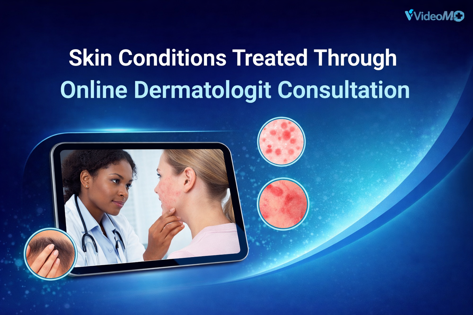 Skin Conditions Treated Through Online Dermatologist Consultation