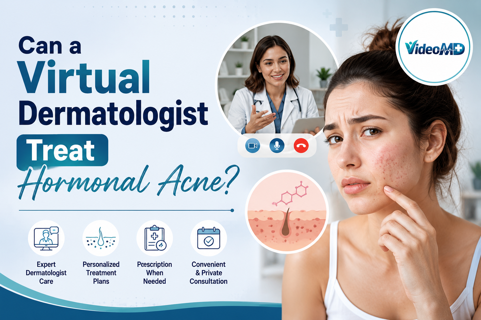Can a Virtual Dermatologist Treat Hormonal Acne?